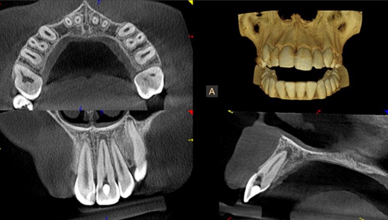 cbct picture